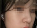복코 한달차 후기입니다!